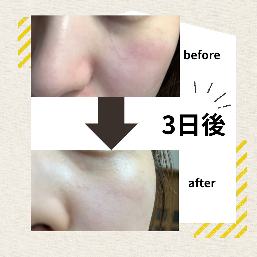 AZ アゼフィットスポッツ/NIKI PITA/フェイスクリームを使ったクチコミ(2枚目)