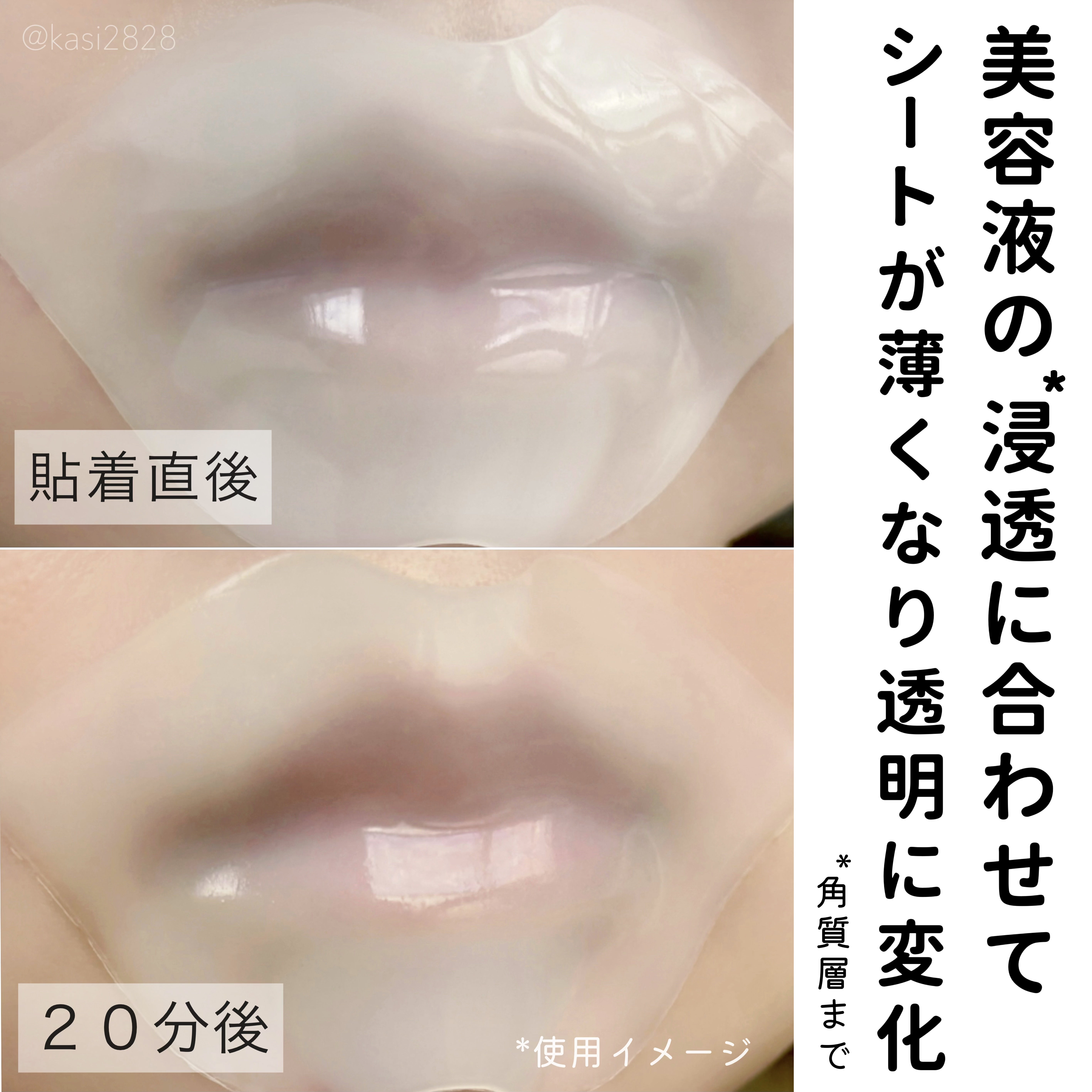 リップパック 集中トリートメントタイプ＜ハーバルミックスの香り＞/CHOOSY/リップマスクを使ったクチコミ（2枚目）