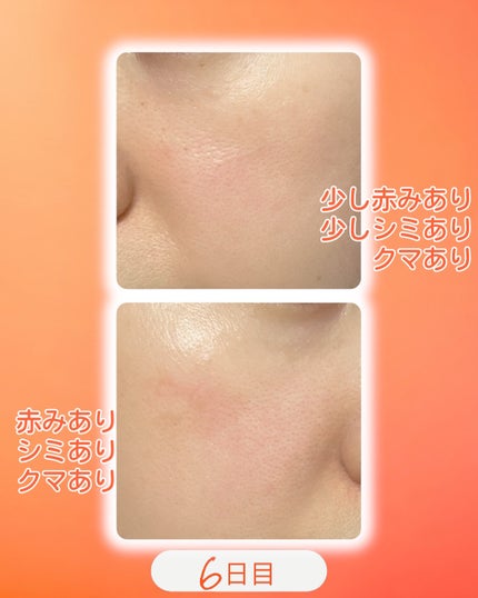 TXトーニングデイリーマスク/VT/その他スキンケアを使ったクチコミ(2枚目)