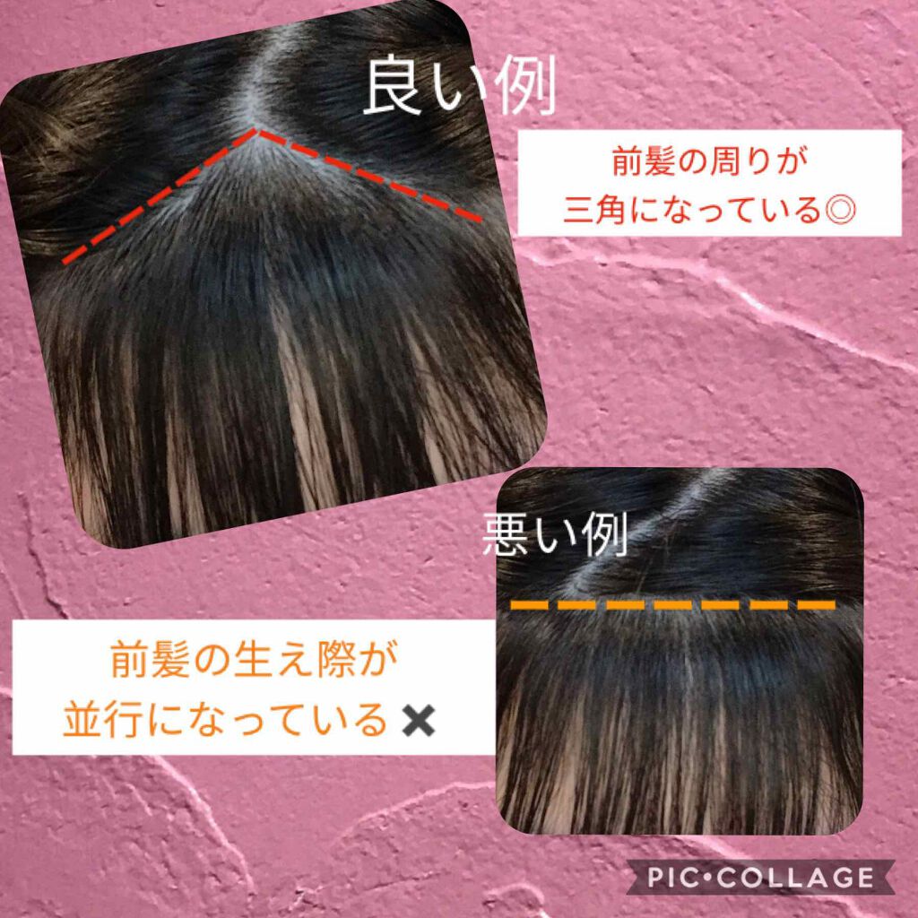 ヘアピン/DAISO/ヘアアクセサリーを使ったクチコミ（2枚目）