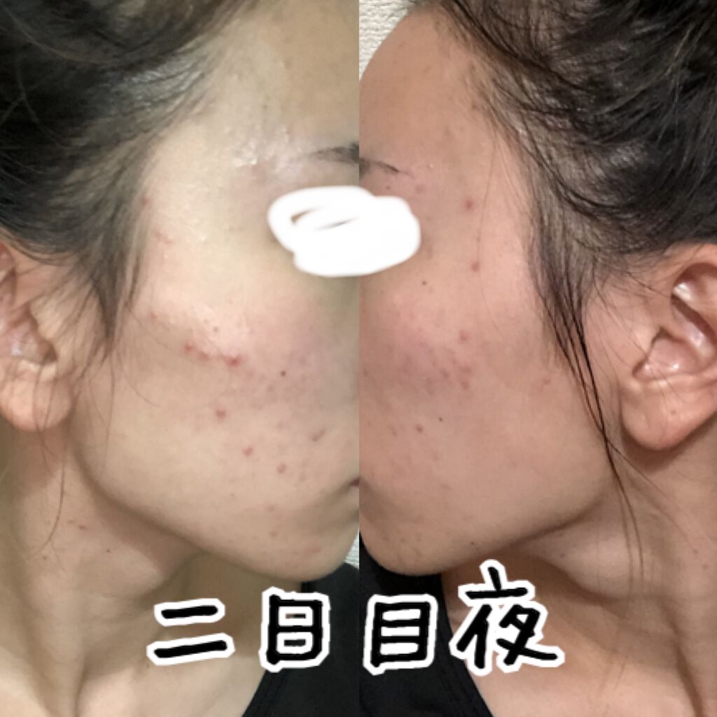 デュオ ザ クレンジングバーム ホワイトa/DUO/クレンジングバームを使ったクチコミ（2枚目）