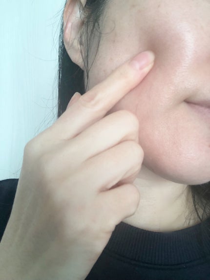 ポーラ リンクルショット メディカル セラム デュオ/リンクルショット/美容液を使ったクチコミ(4枚目)