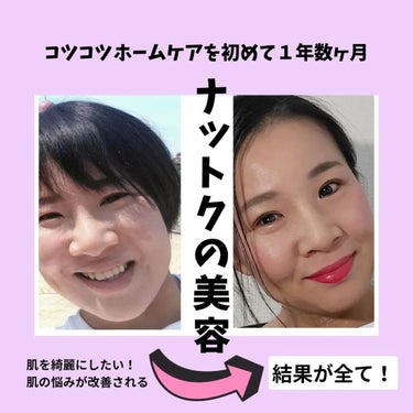 美肌カウンセラー💆綺麗のお助け相談所 on LIPS 「【コツコツ美容🧙】一生使い続けたいスキンケアに出逢えた幸せと安..」（1枚目）