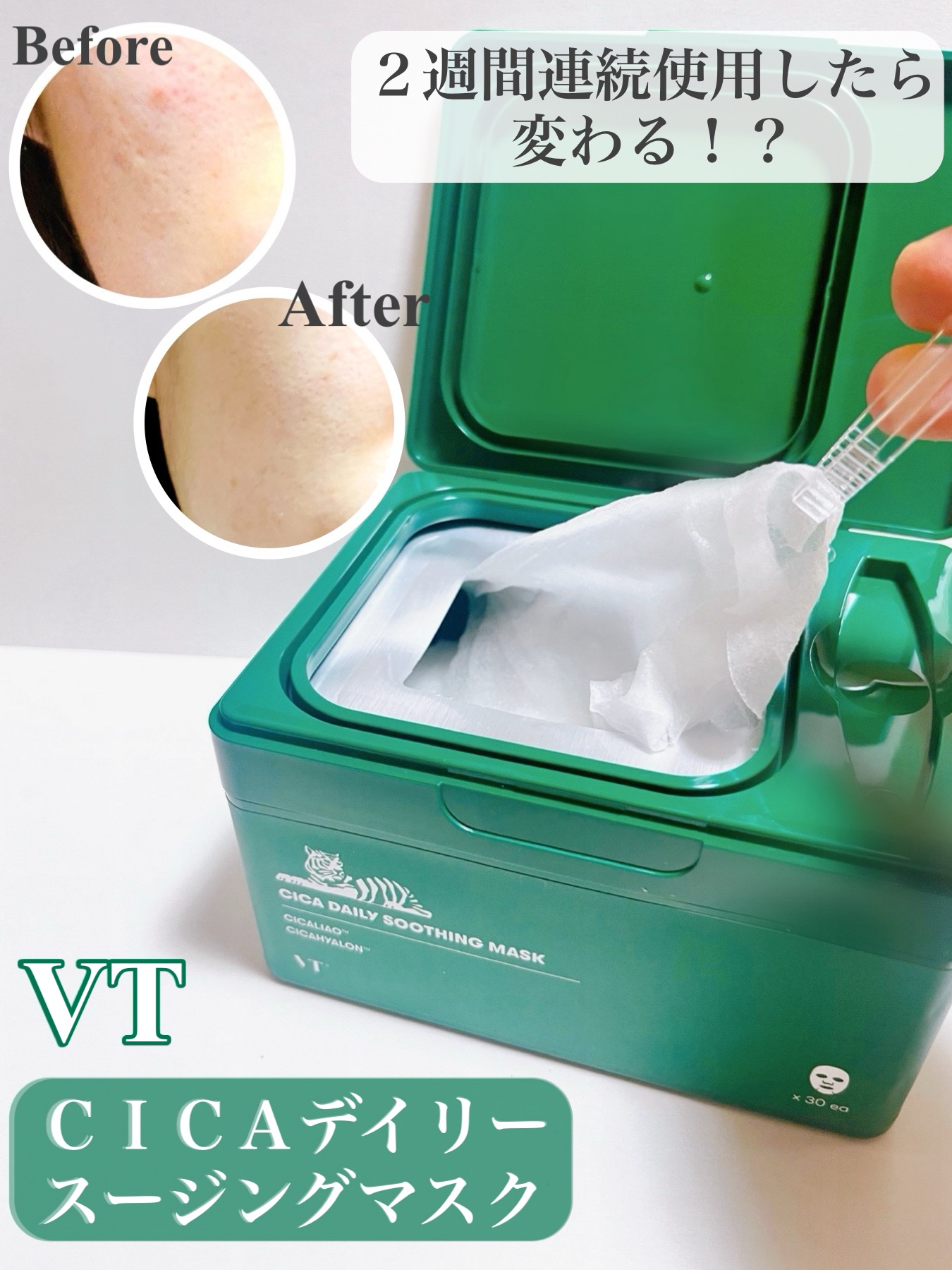 CICA デイリースージングマスク/VT/シートマスク・パックを使ったクチコミ（1枚目）