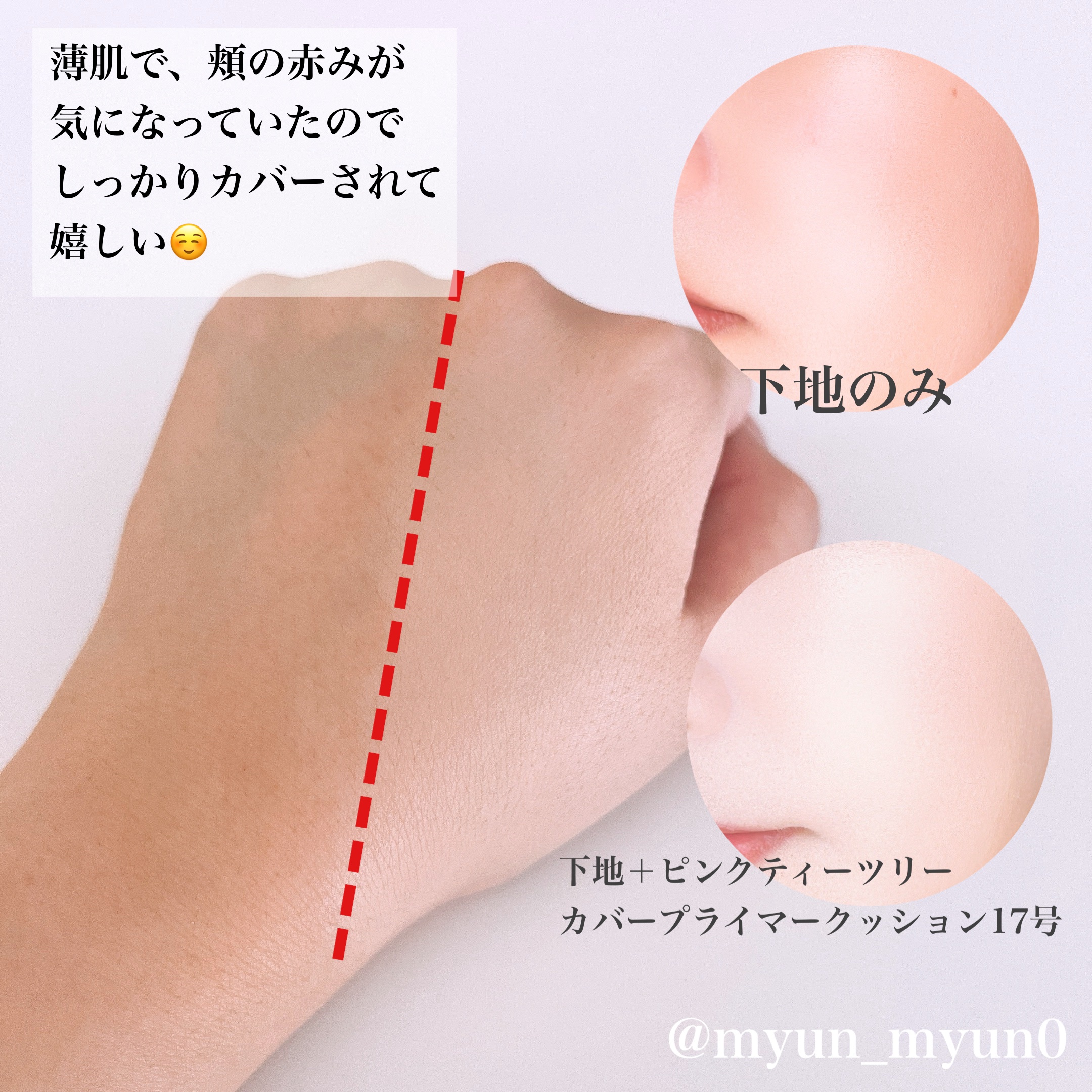 ピンクティーツリーカバークッション 17号 ポーセリンベージュ/APLIN/クッションファンデーションを使ったクチコミ（3枚目）