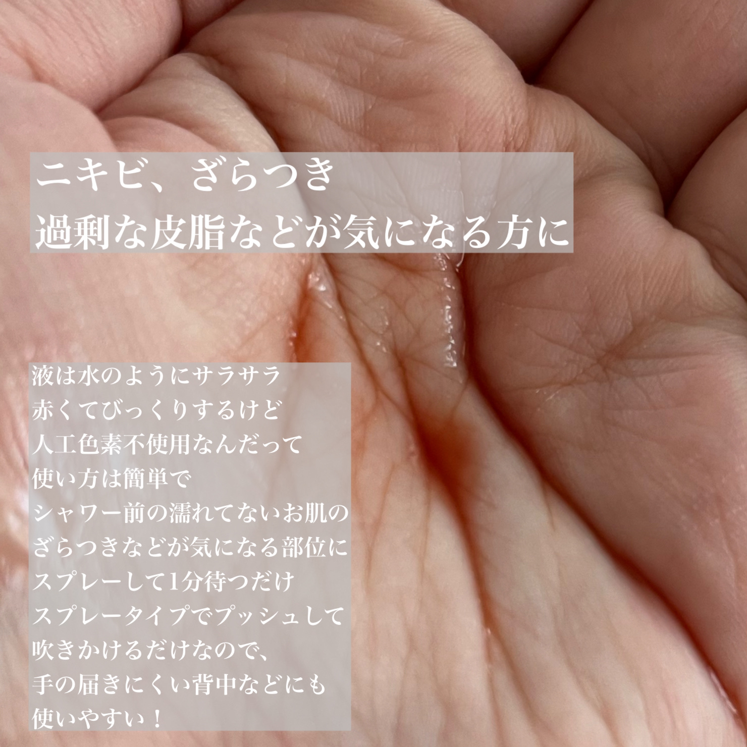 レッドアクネ ボディピーリングショット/MEDICUBE/ピーリングを使ったクチコミ（2枚目）