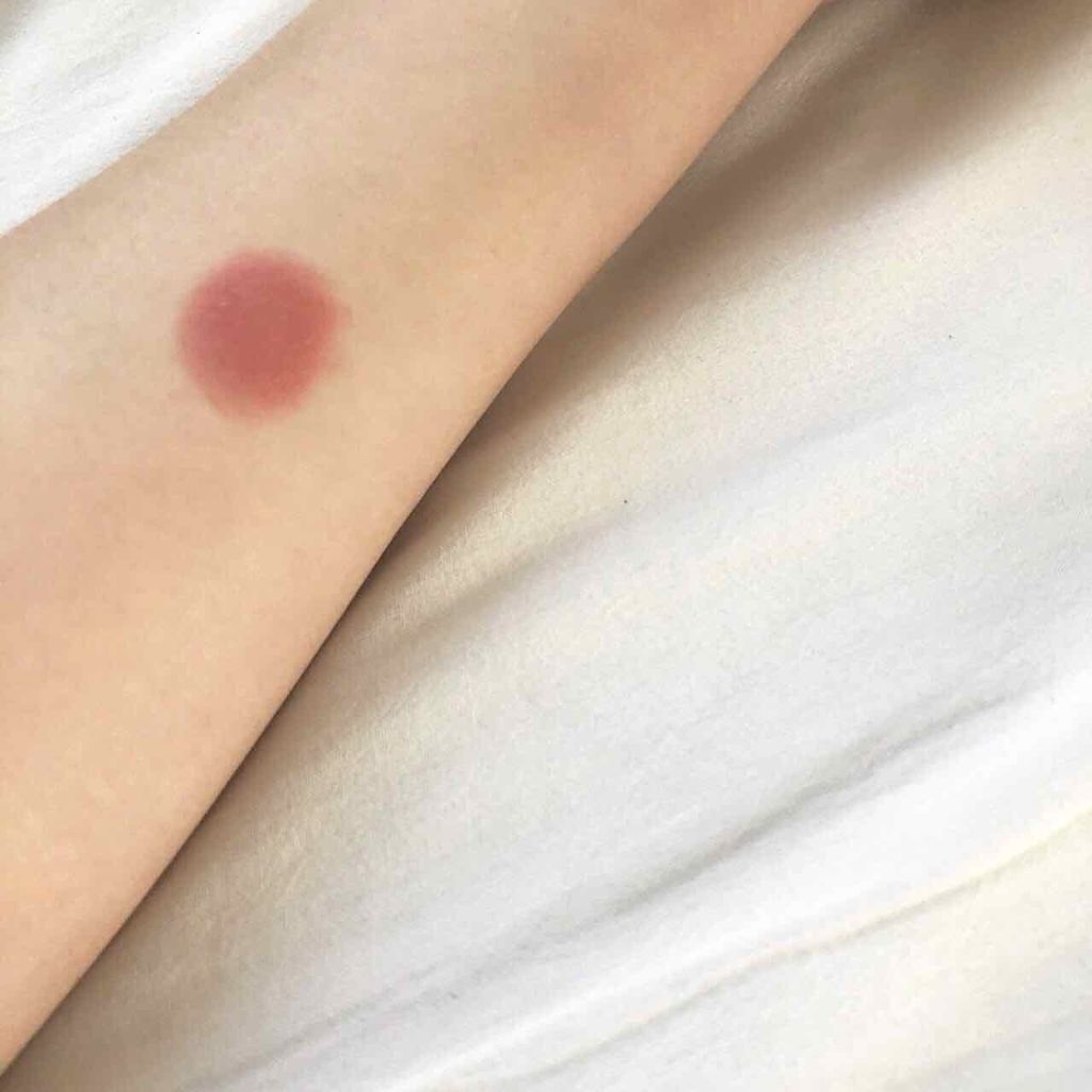 クリニーク ポップ/CLINIQUE/口紅を使ったクチコミ(2枚目)