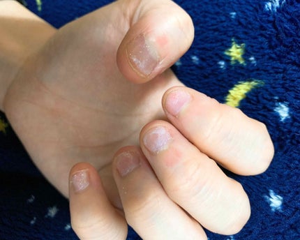 サンリオネイル/DAISO/マニキュアを使ったクチコミ(4枚目)