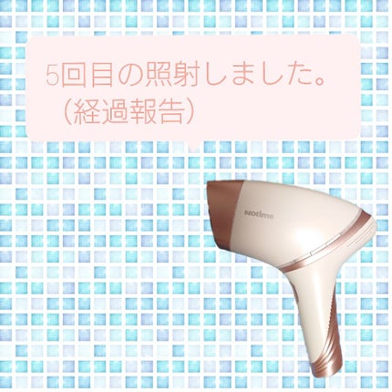 アイスレディ/icelady/家庭用脱毛器を使ったクチコミ(1枚目)