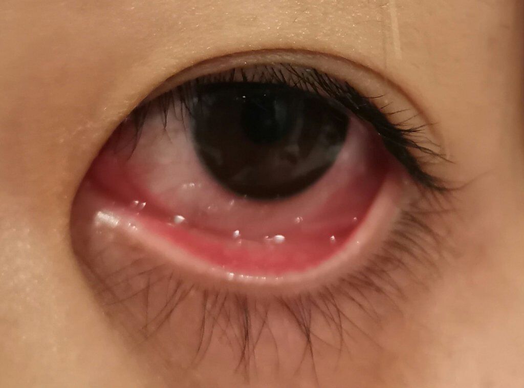 EMAKED（エマーキット）/水橋保寿堂製薬/まつげ美容液を使ったクチコミ（3枚目）