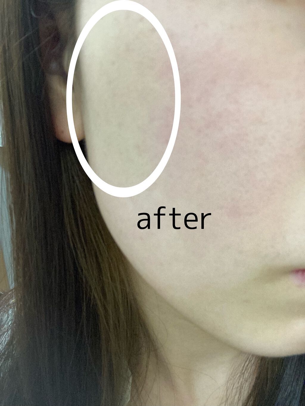 カバーパーフェクション チップコンシーラー/the SAEM/リキッドコンシーラーを使ったクチコミ(3枚目)