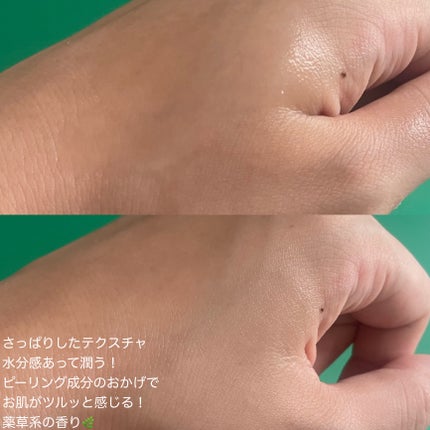 AHA·BHA·PHA 30デイズミラクルトナー/SOME BY MI/化粧水を使ったクチコミ(4枚目)