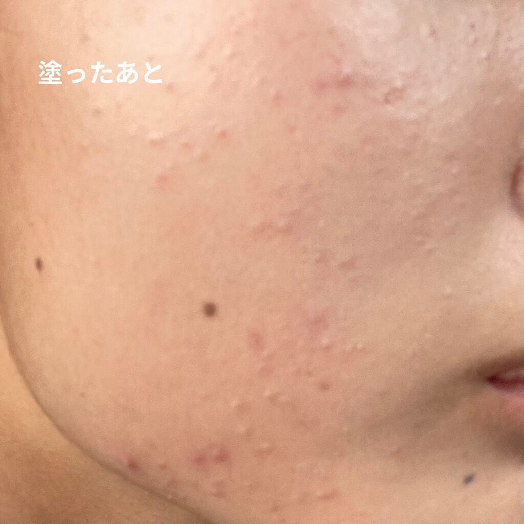 ネオクッション グロウ/LANEIGE/クッションファンデーションを使ったクチコミ(3枚目)