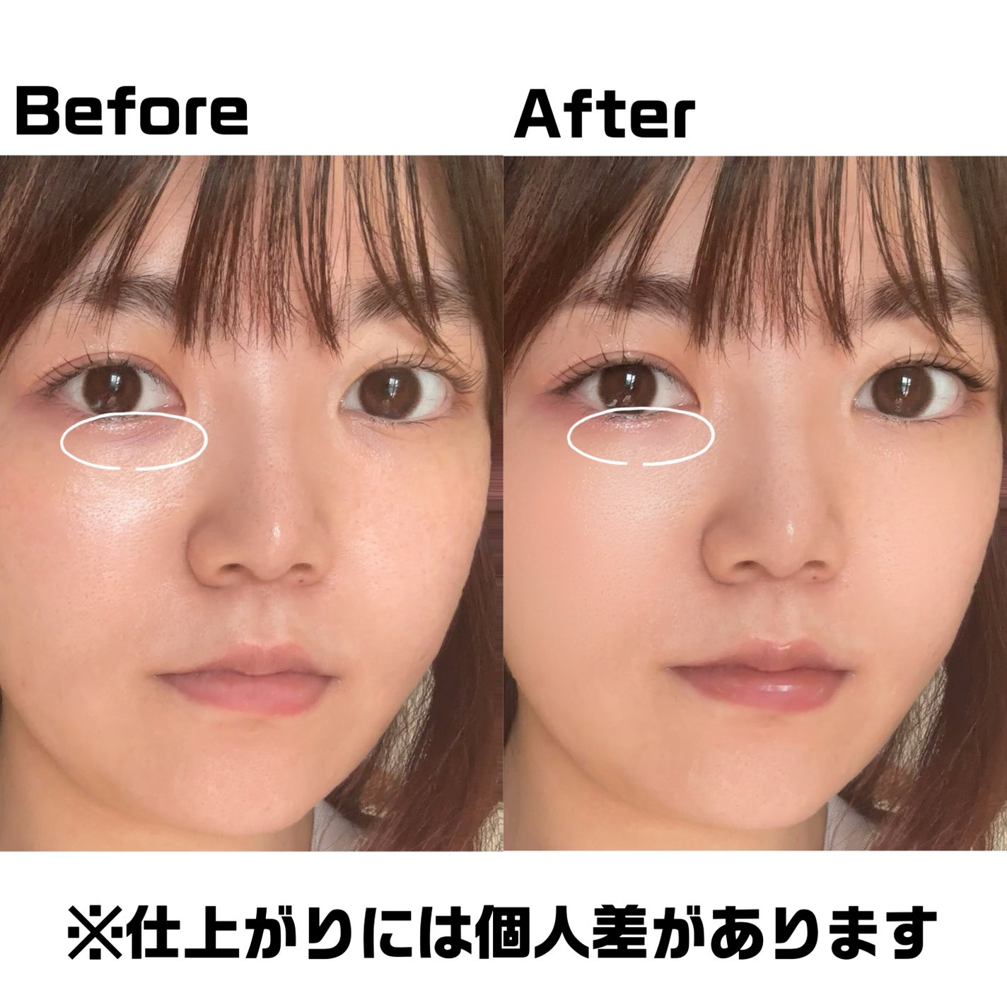 アイレノール クマクリーム/IRENOL/アイケア・アイクリームを使ったクチコミ(4枚目)