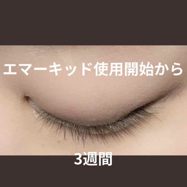 EMAKED（エマーキット）/水橋保寿堂製薬/まつげ美容液を使ったクチコミ（2枚目）