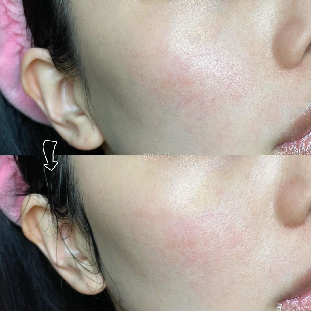 ゼロ毛穴クレイパック/MEDICUBE/洗い流すパック・マスクを使ったクチコミ(4枚目)