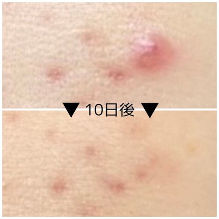 ドクダミ 77 スージングトナー/Anua/化粧水を使ったクチコミ(2枚目)