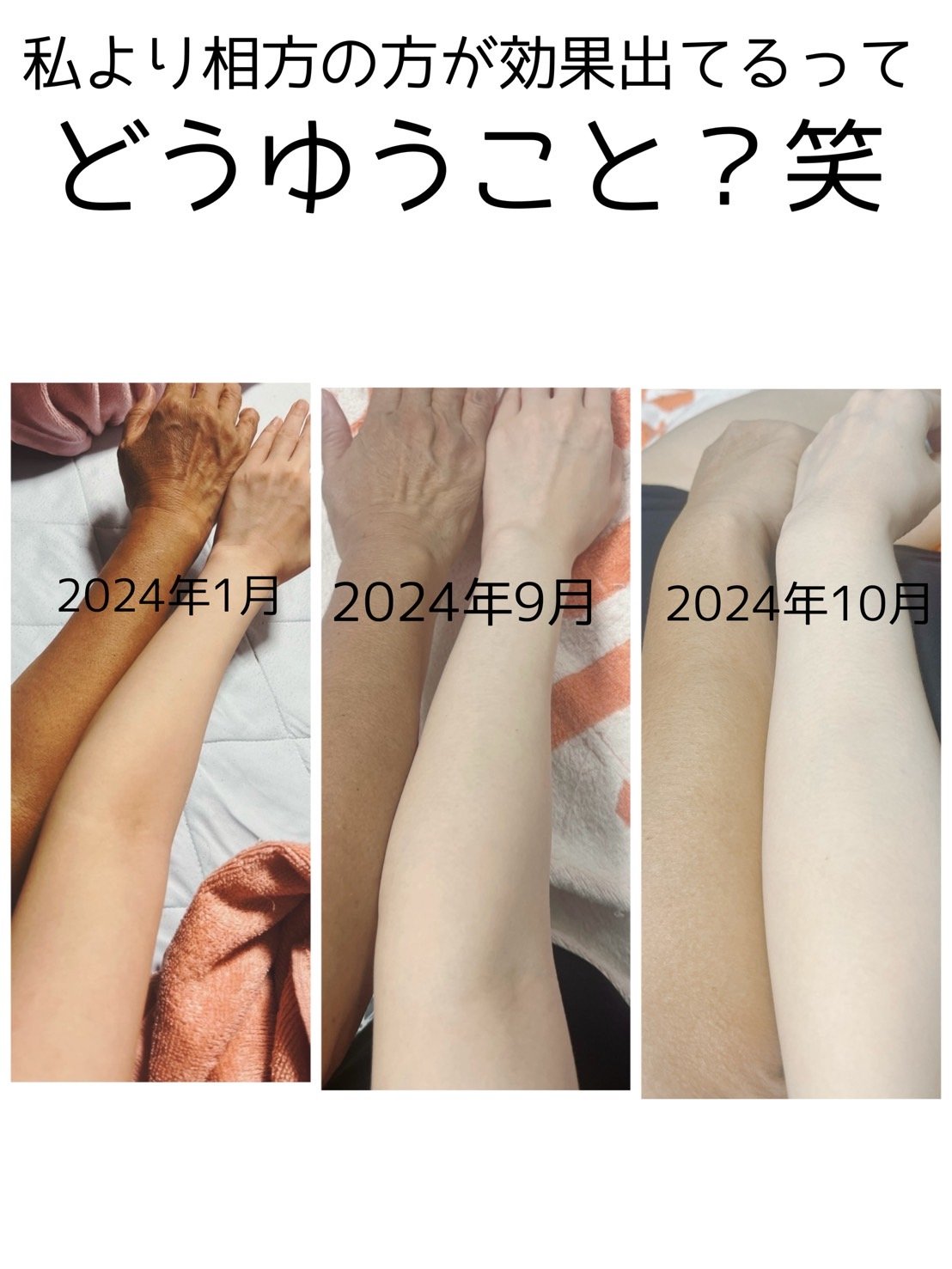 ホワイトーンプラスロゼンジ｜FITANYの効果に関する口コミ - 個包装