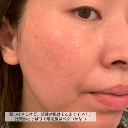 CICA SHEET MASK/tenzero/シートマスク・パックを使ったクチコミ(5枚目)