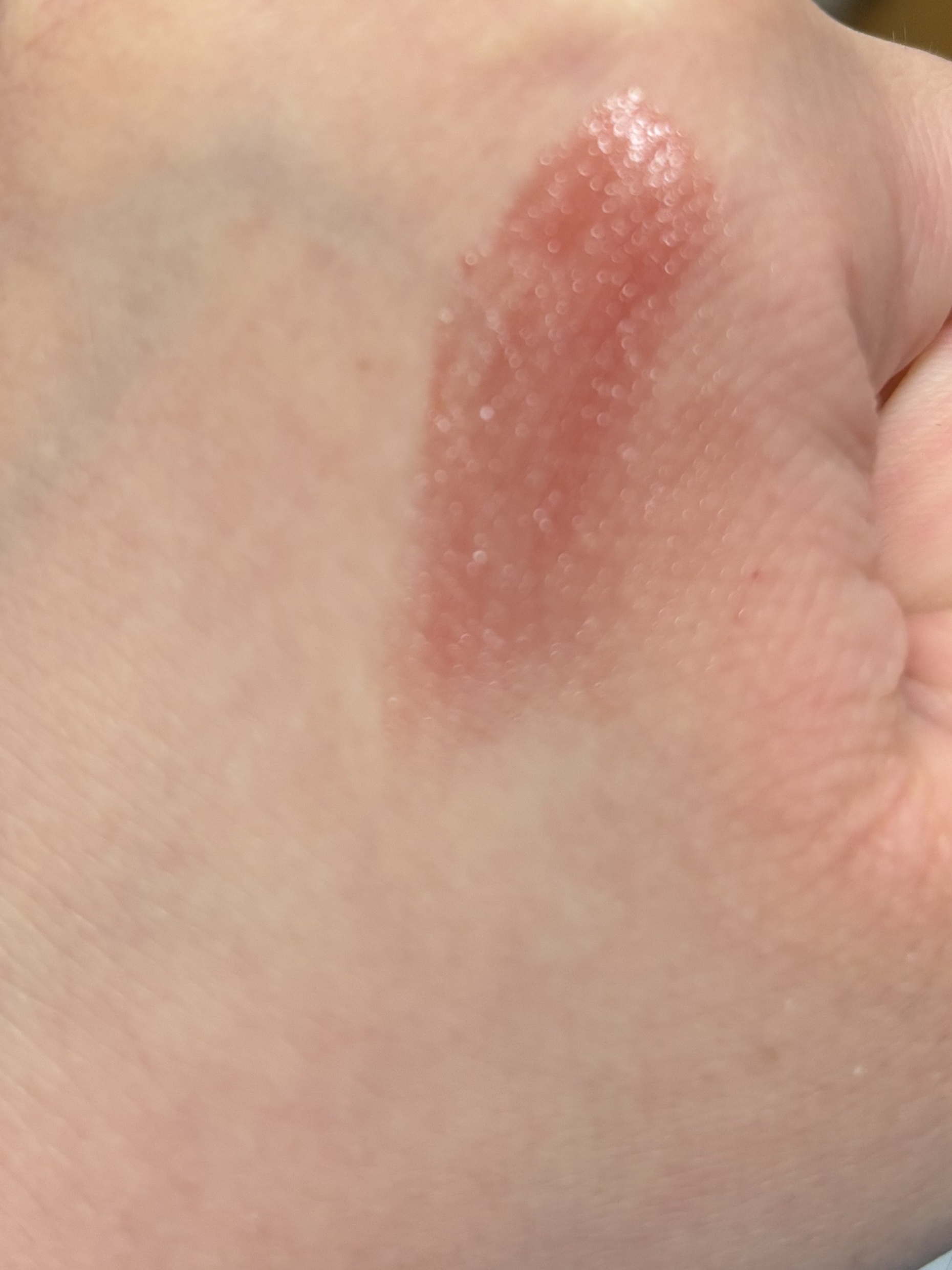 YSL ラブシャイン キャンディグレーズ No.6 バーガンディ テンプテーション/YVES SAINT LAURENT BEAUTE/口紅を使ったクチコミ（2枚目）