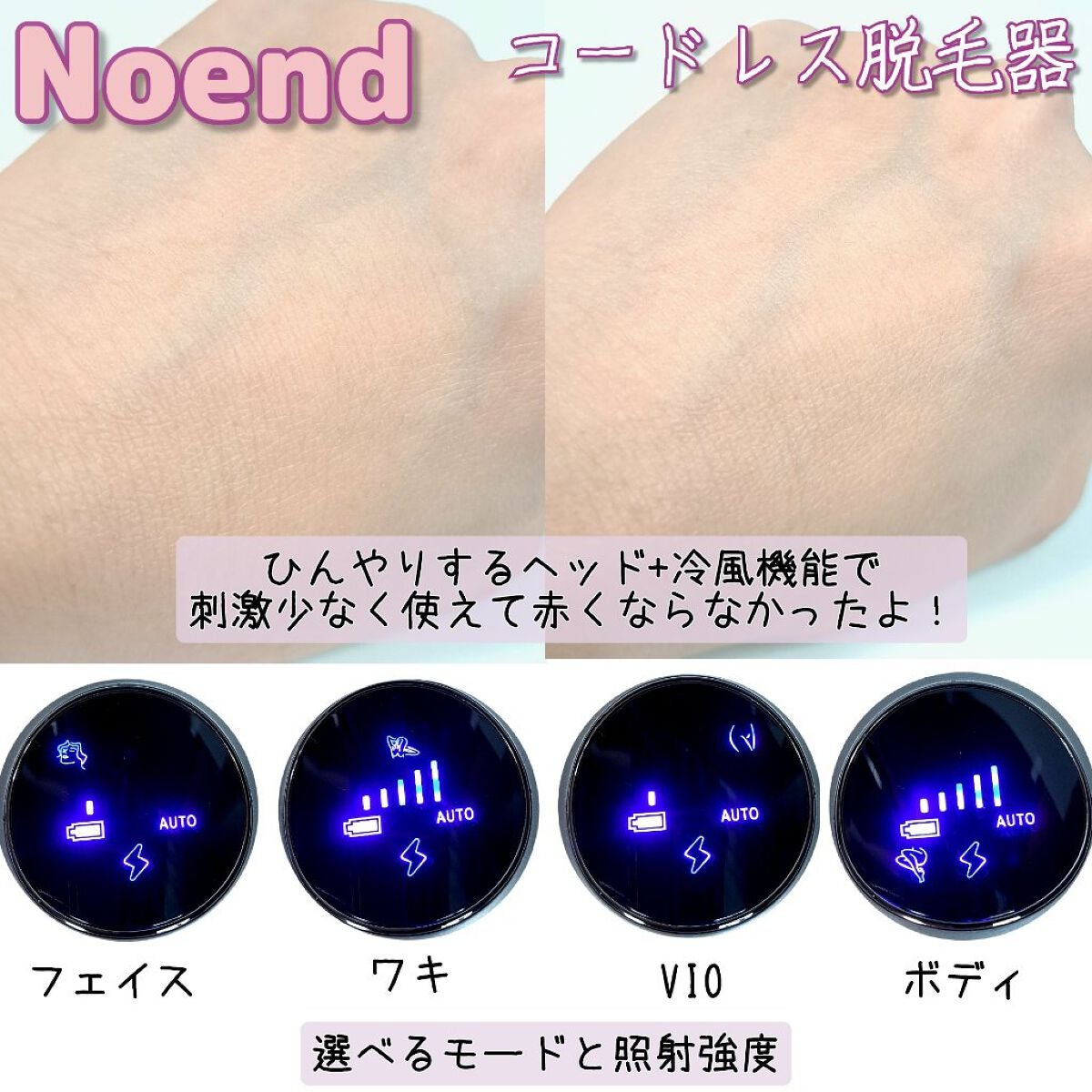 コードレス脱毛器/Noend/家庭用脱毛器を使ったクチコミ(2枚目)