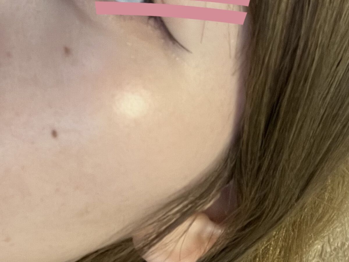 ライトリフレクティングセッティングパウダー　プレスト　N/NARS/プレストパウダーを使ったクチコミ（2枚目）