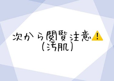 アピュー マデカソ CICAモイスチャージェルクリーム/A’pieu/フェイスクリームを使ったクチコミ（2枚目）