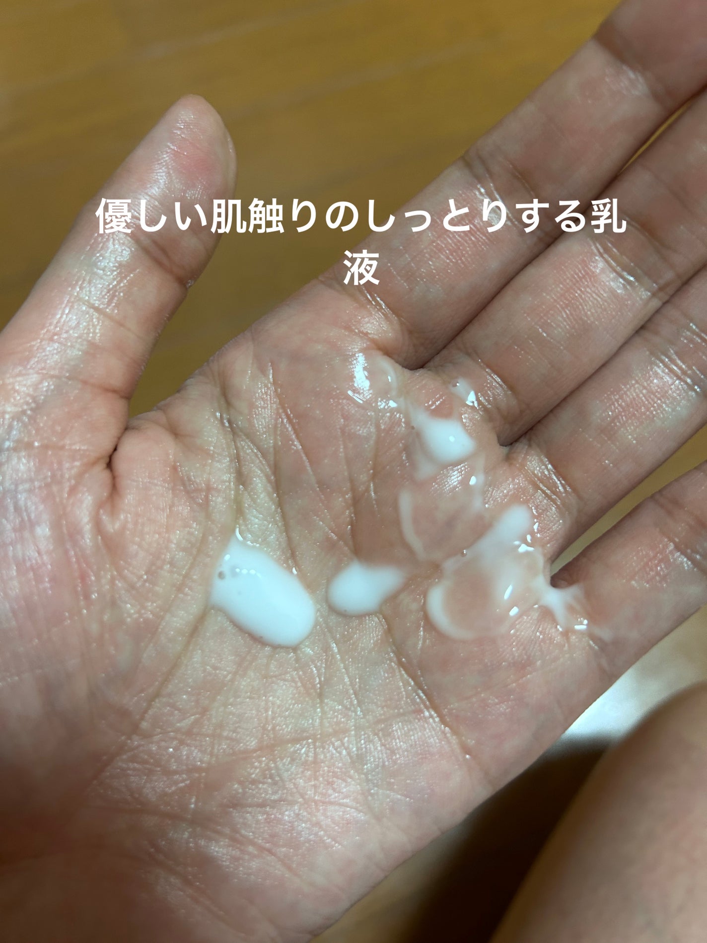 モイストケア ローション MB/d プログラム/化粧水を使ったクチコミ(4枚目)