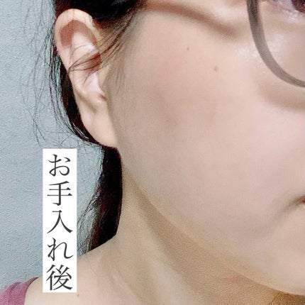 リアルシカペストパック/ビューランチ/洗い流すパック・マスクを使ったクチコミ(4枚目)