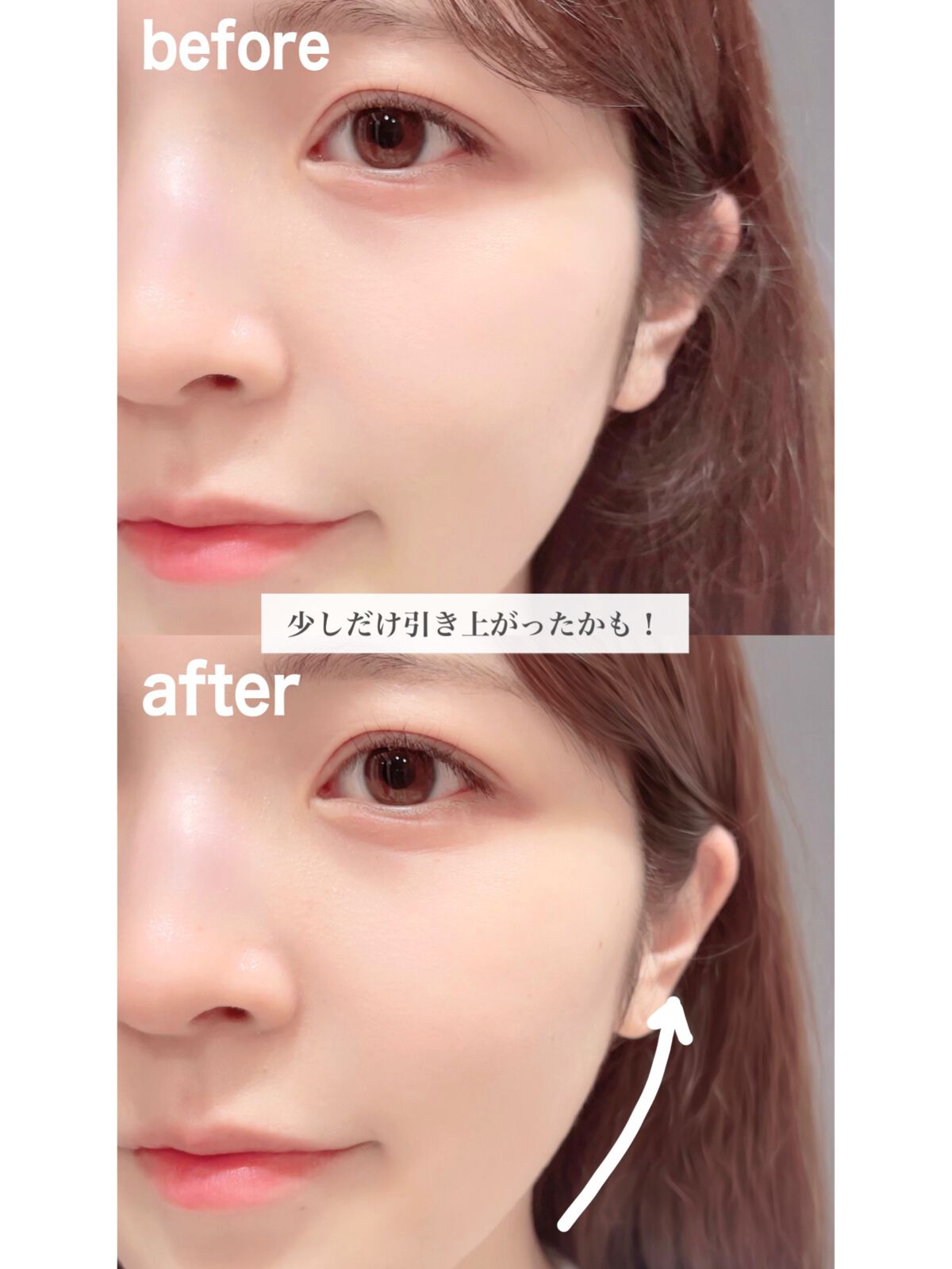 ããŸð°ð·â ìë§ on LIPS ã30åã€ããã ãã§ããªããã¢ãã广ãã·ã¯æ¹å广ããããšèšã..ãïŒ4æç®ïŒ