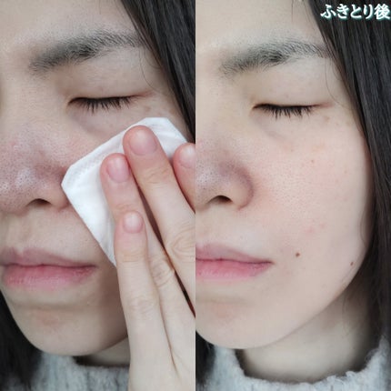 ルクエ コンク/ナリス化粧品/拭き取り化粧水を使ったクチコミ(6枚目)