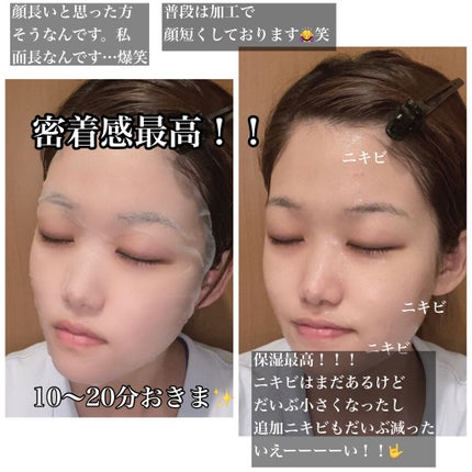 ティーツリーケア ソリューション エッセンシャルマスクEX/MEDIHEAL/シートマスク・パックを使ったクチコミ(5枚目)