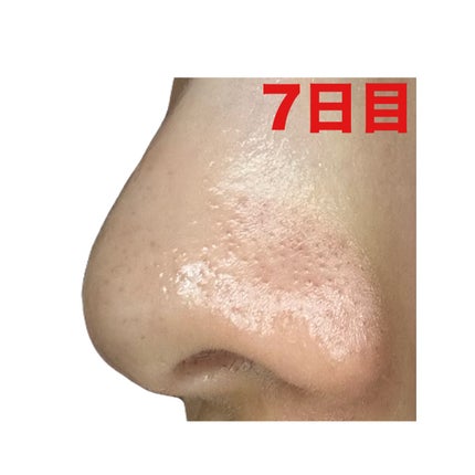 ディープクリア酵素洗顔 /メラノCC/洗顔フォームを使ったクチコミ(9枚目)