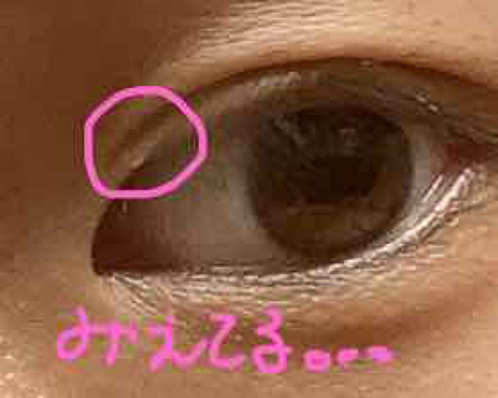 のびーるアイテープ(絆創膏タイプ、レギュラー)/DAISO/二重まぶた用アイテムを使ったクチコミ(3枚目)