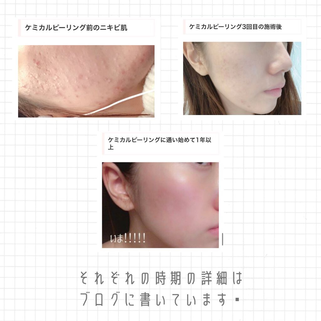 CICA マイルドフォームクレンザー/VT/洗顔フォームを使ったクチコミ(4枚目)