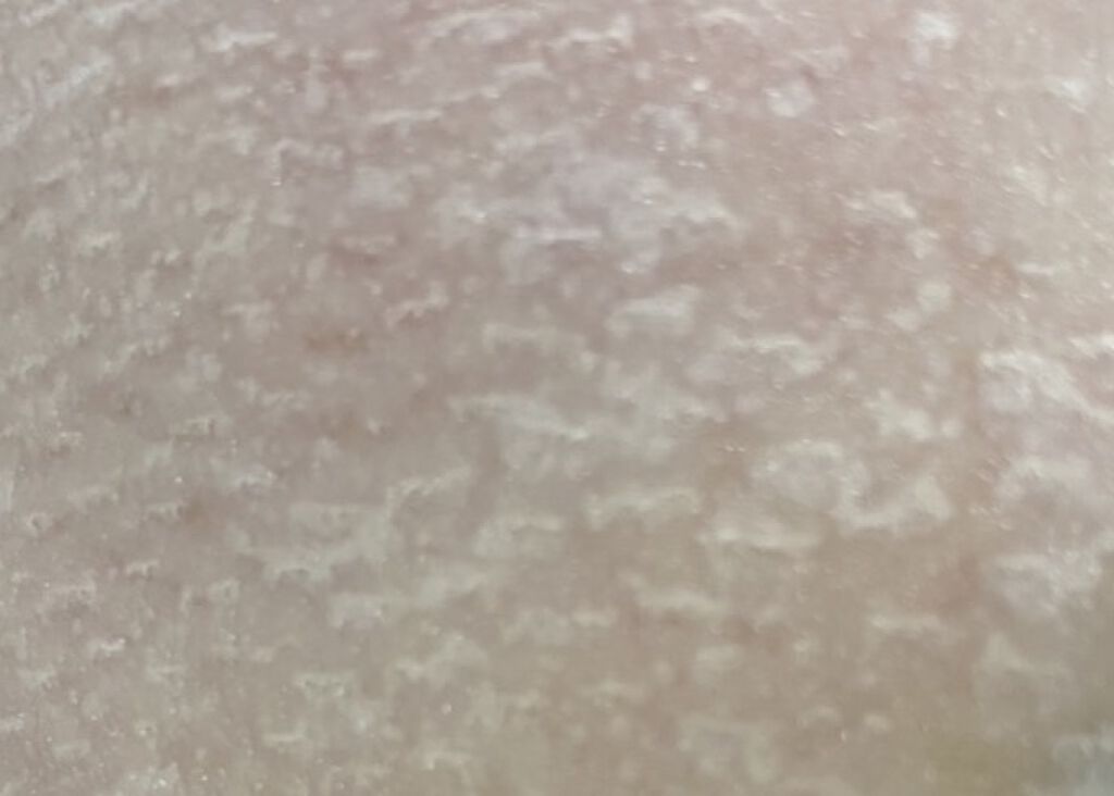 毛穴小町マスク		/クリアターン/シートマスク・パックを使ったクチコミ（3枚目）