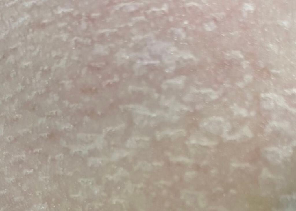 毛穴小町マスク /クリアターン/シートマスク・パックを使ったクチコミ(3枚目)