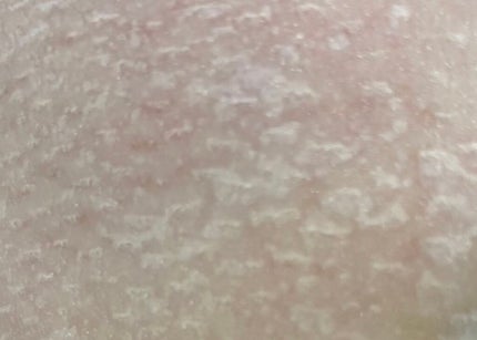 毛穴小町マスク /クリアターン/シートマスク・パックを使ったクチコミ(3枚目)