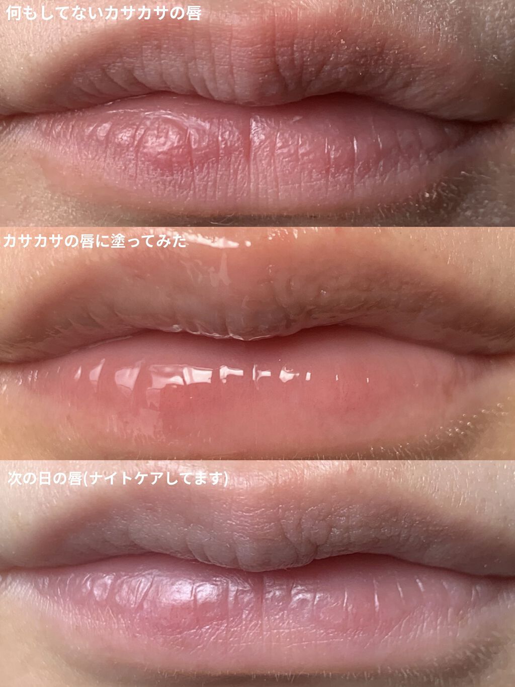 リップ美容液/WHOMEE/リップ美容液を使ったクチコミ（2枚目）