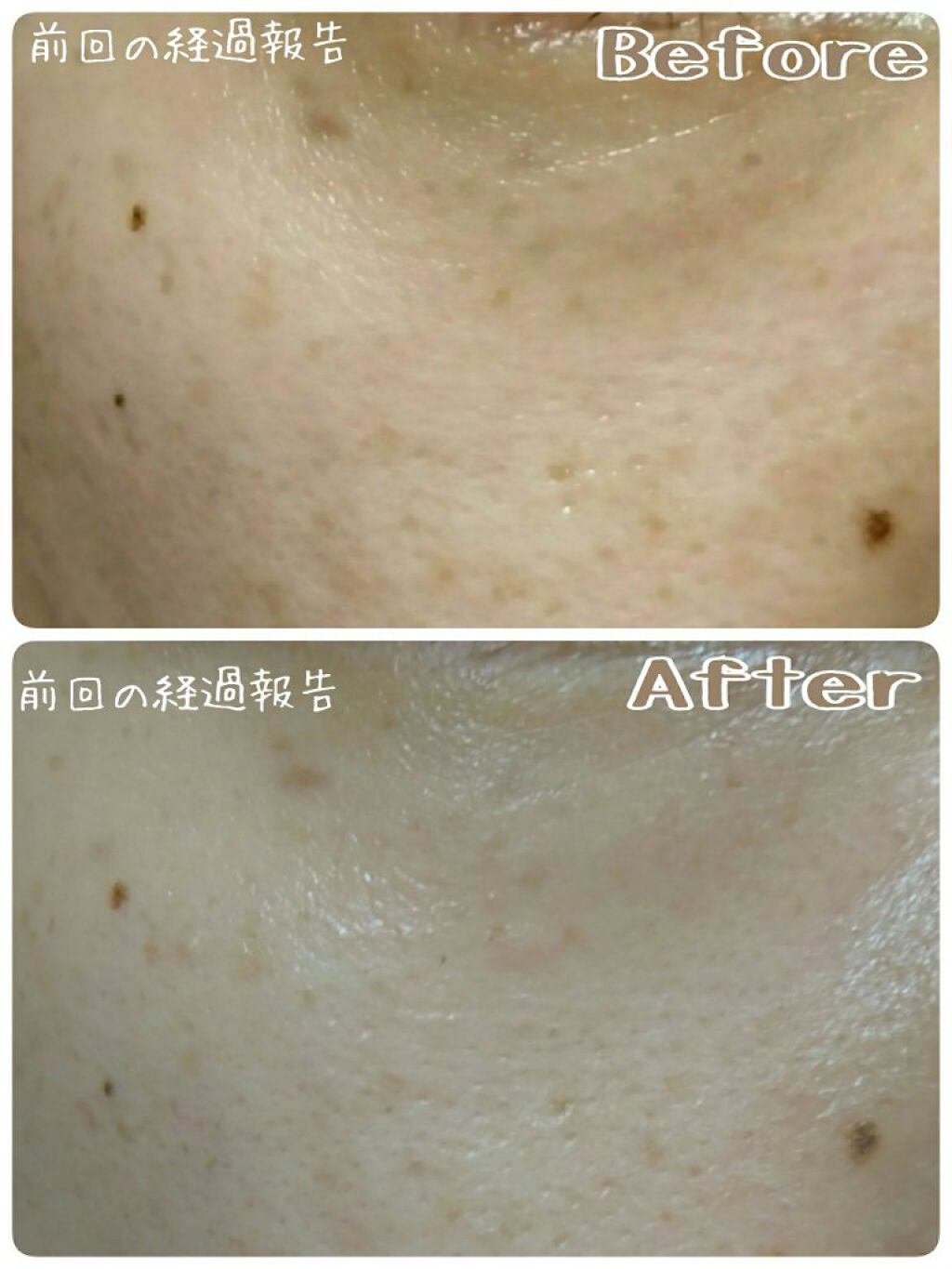 エリクシール ホワイト リセット ブライトニスト/エリクシール/フェイスクリームを使ったクチコミ(2枚目)