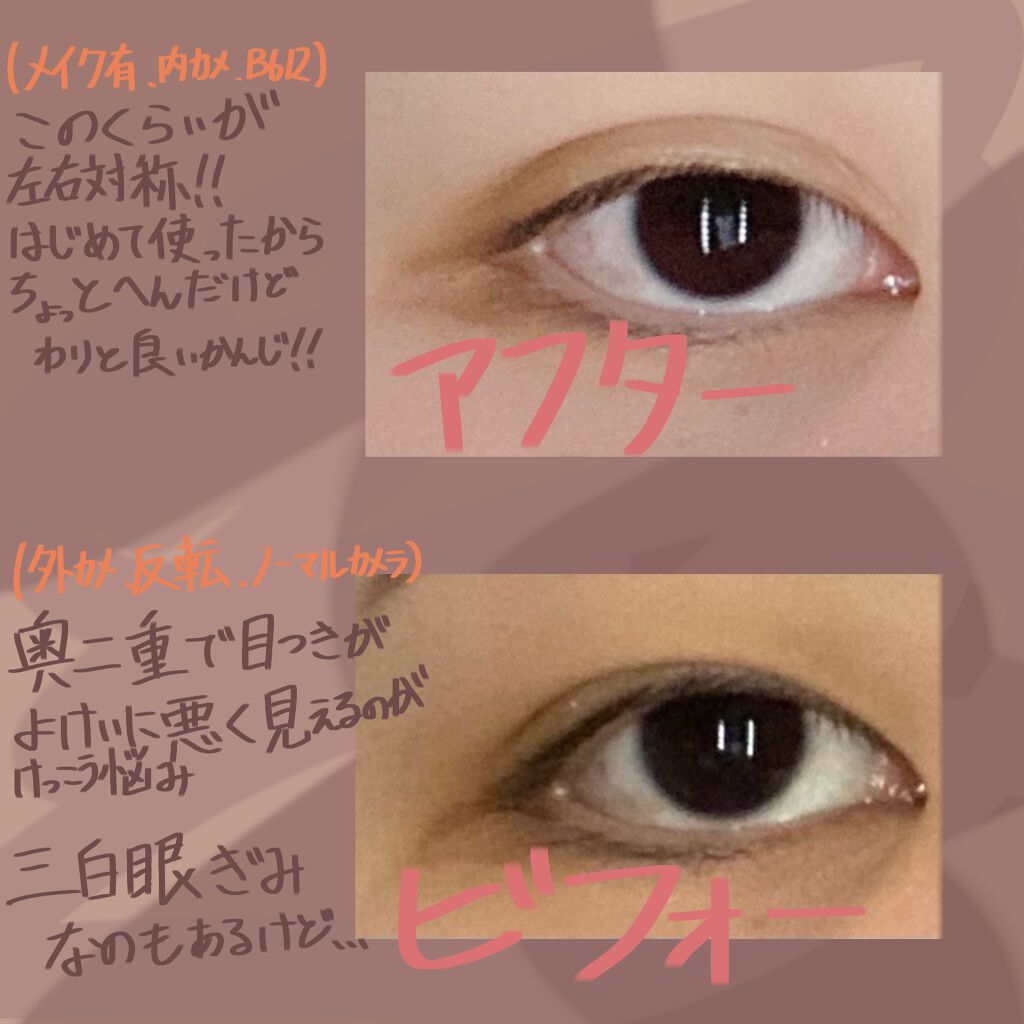 オリシキ アイリッドスキンフィルム /D-UP/二重まぶた用アイテムを使ったクチコミ(2枚目)