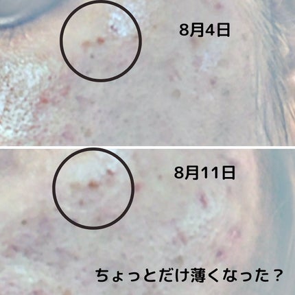 ディープビタCパッチ/MEDICUBE/その他スキンケアを使ったクチコミ(4枚目)