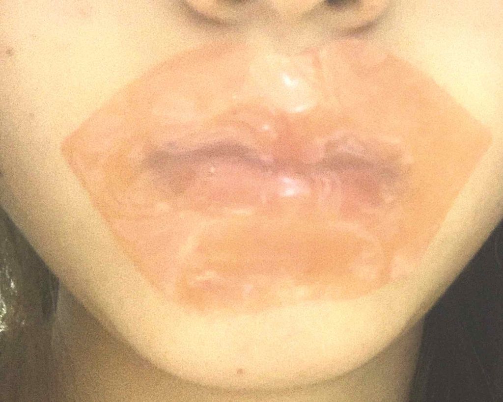 リップパック /CHOOSY/リップマスクを使ったクチコミ(2枚目)