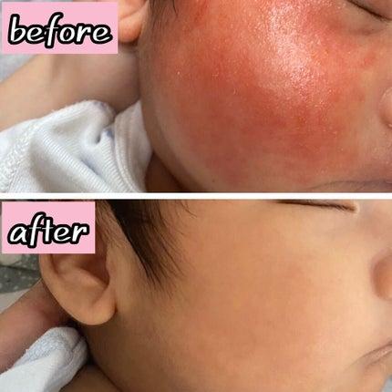 ローション 410ml/キュレル/ボディローションを使ったクチコミ(1枚目)