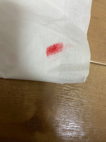 リップスティックF/ANNA SUI/口紅を使ったクチコミ(3枚目)