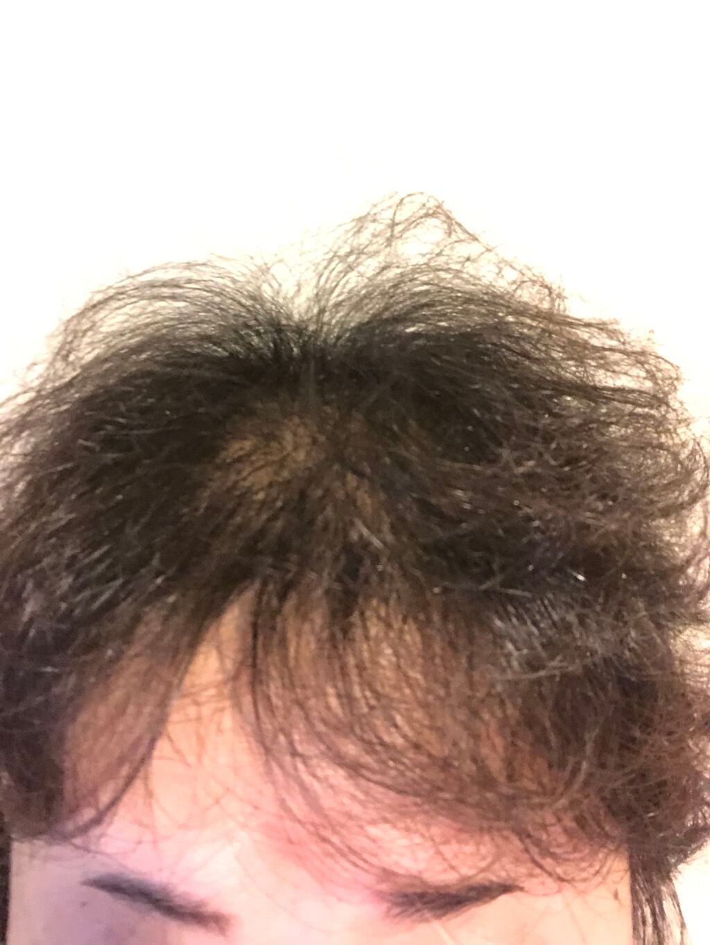 ルメント スパークリングオイル クレンジング&シャンプー/Le ment/市販シャンプーを使ったクチコミ(4枚目)