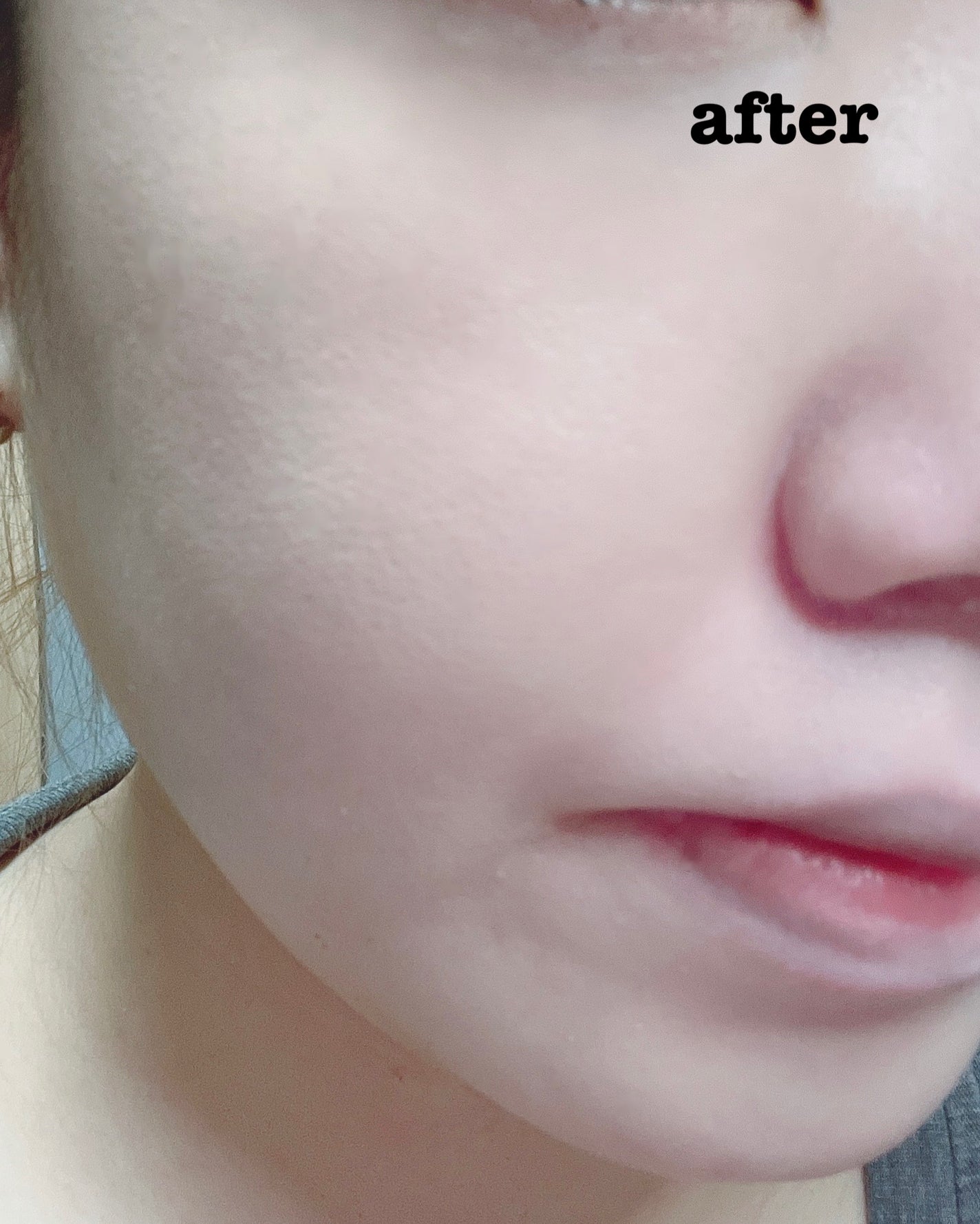 ピンクティーツリーカバーアップグロウクッション/APLIN/クッションファンデーションを使ったクチコミ(3枚目)