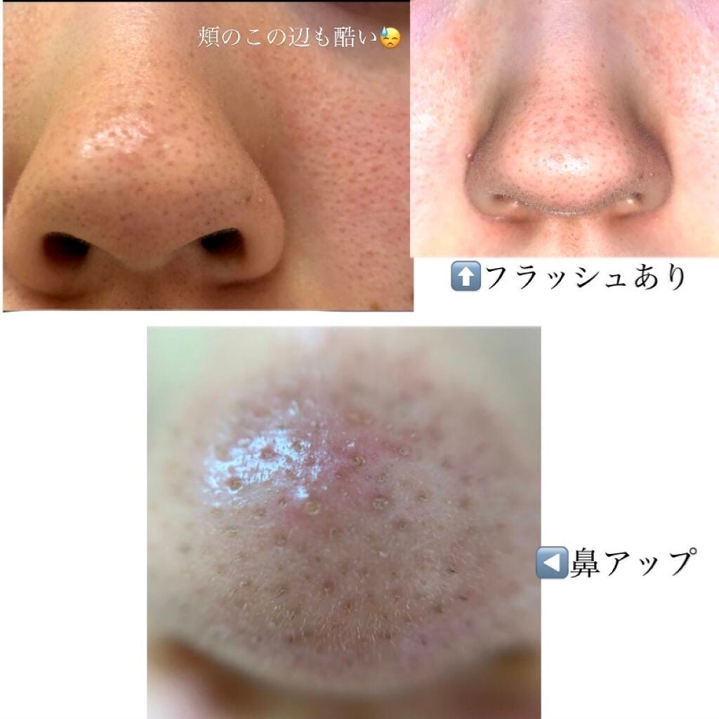 ハトムギ保湿ジェル(ナチュリエ スキンコンディショニングジェル)/ナチュリエ/美容液を使ったクチコミ(3枚目)