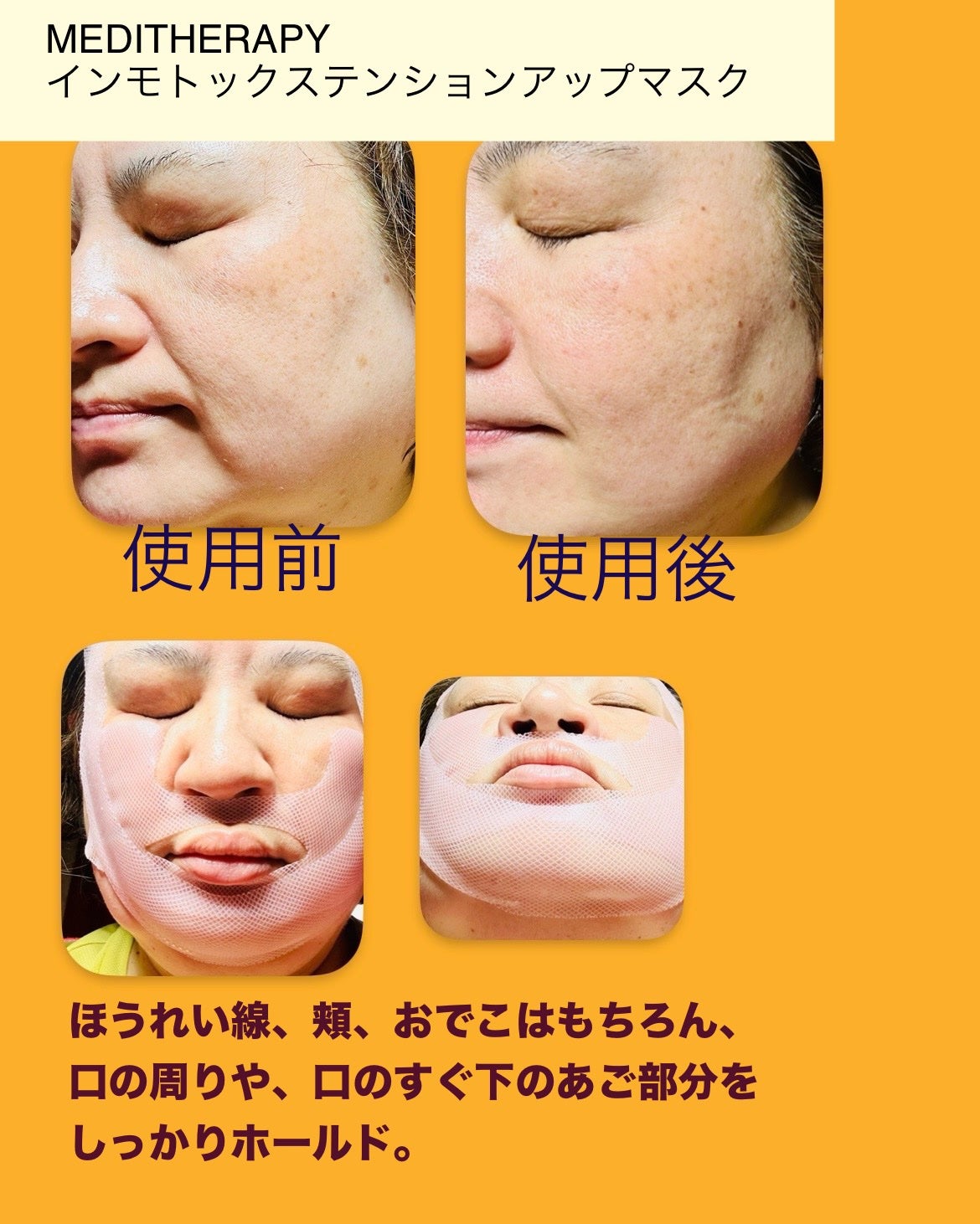インモトックステンションアップマスク/MEDITHERAPY/シートマスク・パックを使ったクチコミ(5枚目)
