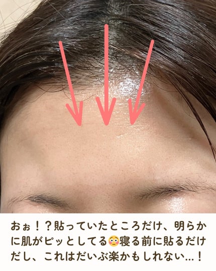 額のしわパッチ/MARSHIQUE/その他スキンケアグッズを使ったクチコミ(5枚目)